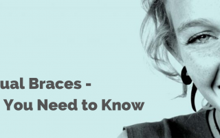 Lingual braces: everything you need to know