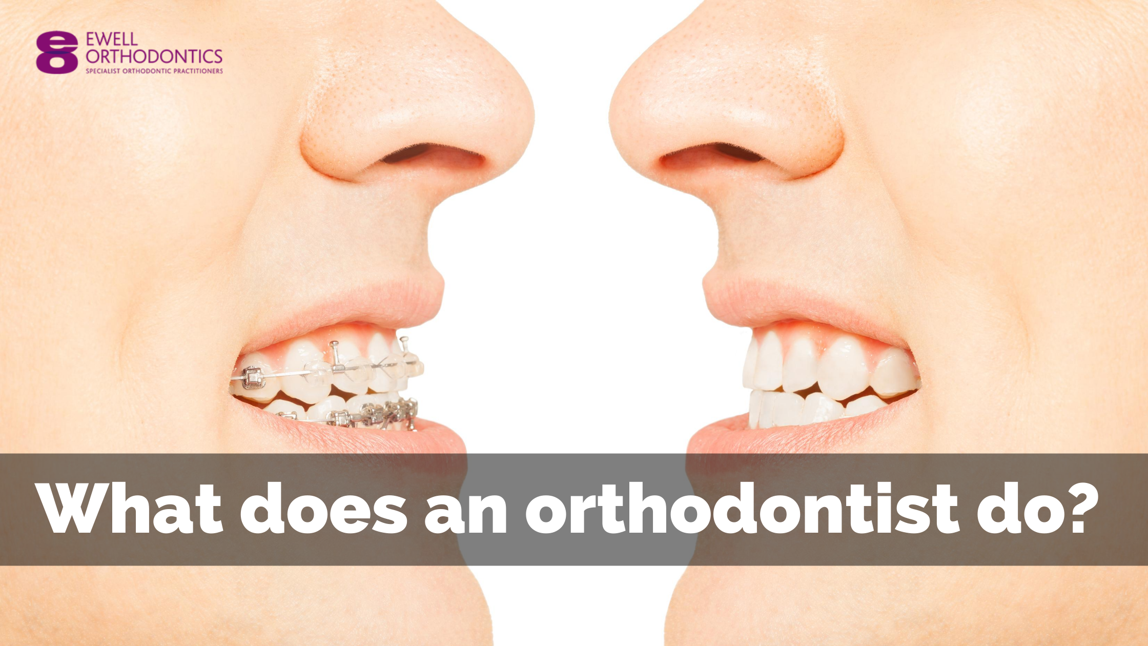 Orthodontics Reston