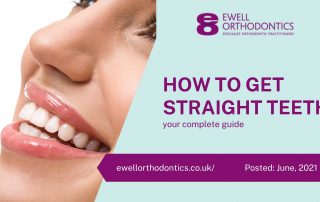 How to get straight teeth